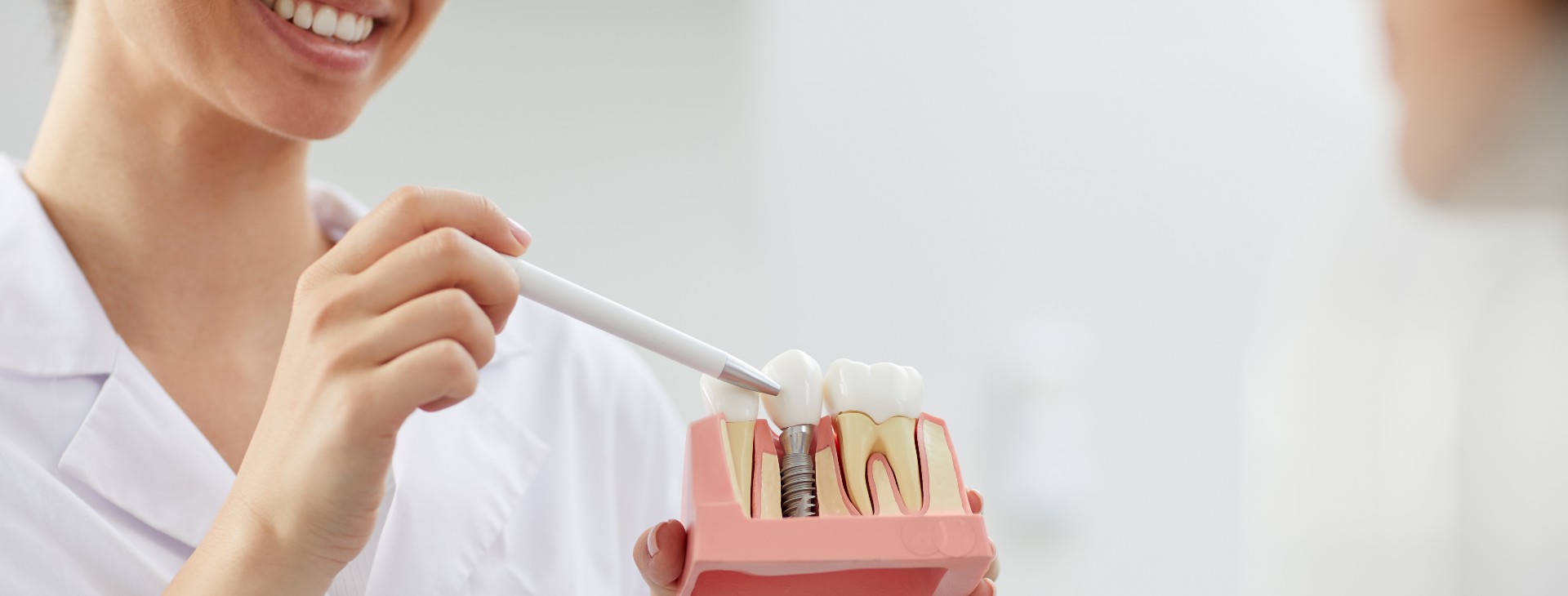 implant dentar in rate Bucuresti