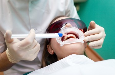 Estetica dentara in Bucuresti